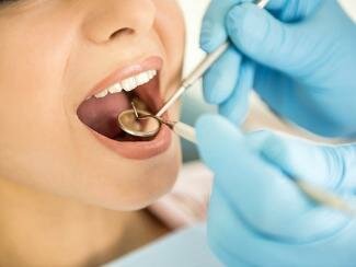Лечение кариеса